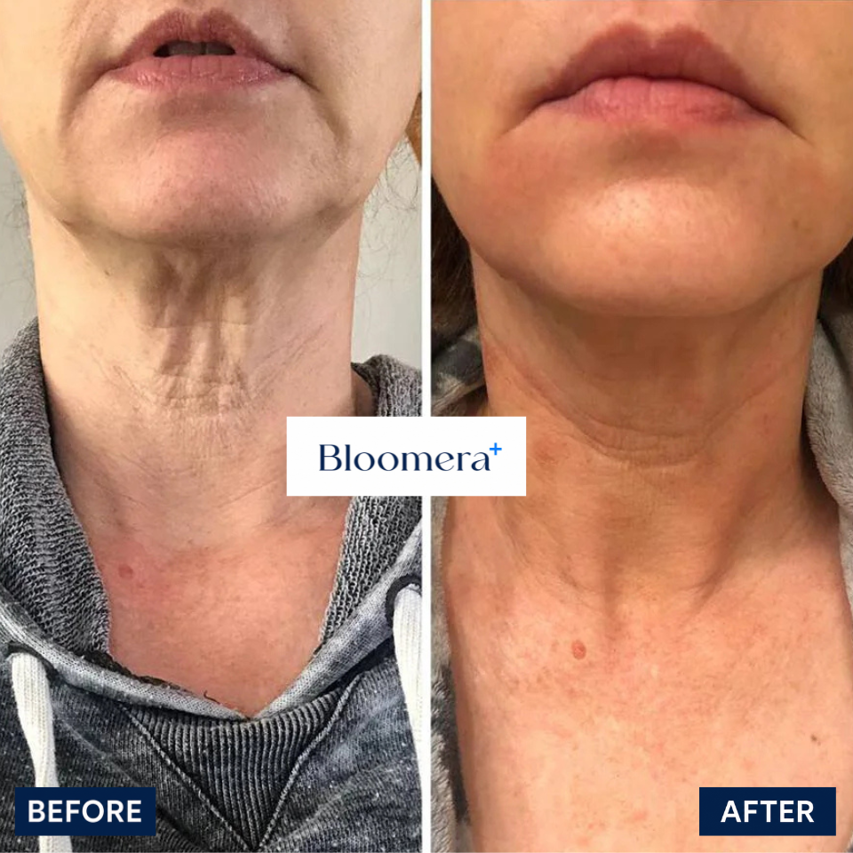 Face-to-Neck Age Gap Elixir image 4