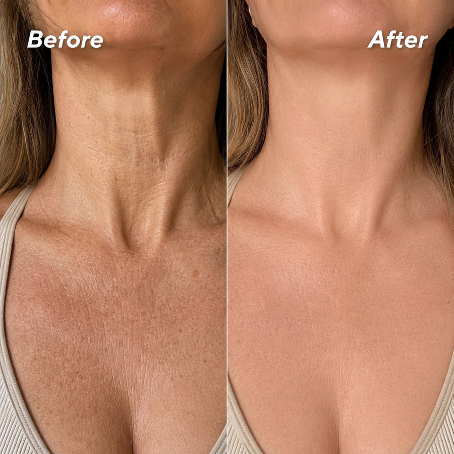 Softens The Look Of Neck Lines
