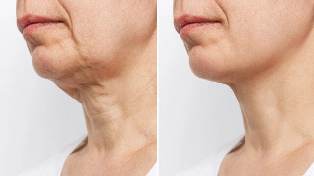 Bloomera Tighten & Lift Neck Cream
