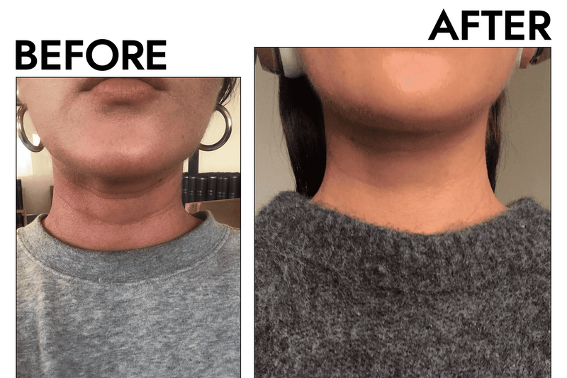 I Stopped Hiding My Neck In Photos